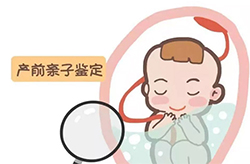 新疆孕期亲子鉴定要如何办理,新疆怀孕亲子鉴定中心在哪有